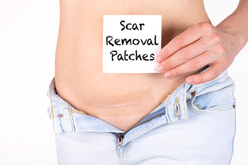 scar removal patches